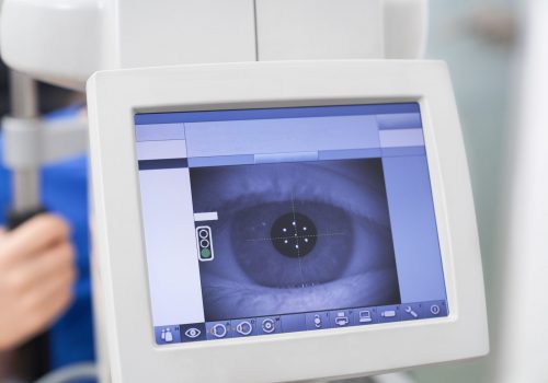 Optik Sinir ve Görme Yolları Hastalıkları